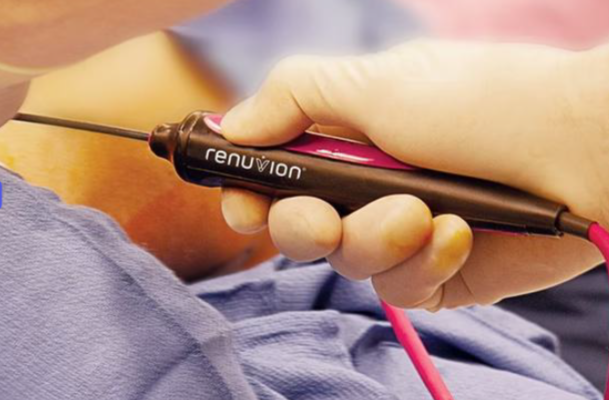 skin tightening lipedema