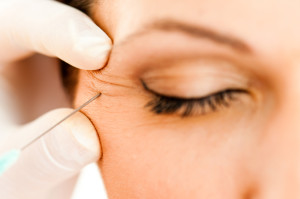 Wrinkle treatment in guilford ct 